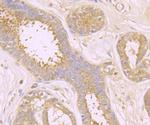 TAK1 Antibody in Immunohistochemistry (Paraffin) (IHC (P))