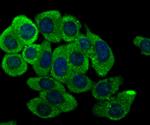 Kir3.4 (KCNJ5) Antibody in Immunocytochemistry (ICC/IF)