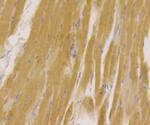 Kir3.4 (KCNJ5) Antibody in Immunohistochemistry (Paraffin) (IHC (P))