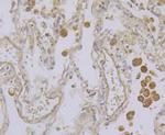 Kir3.4 (KCNJ5) Antibody in Immunohistochemistry (Paraffin) (IHC (P))