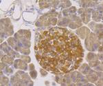 Kir3.4 (KCNJ5) Antibody in Immunohistochemistry (Paraffin) (IHC (P))