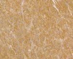 UQCRC2 Antibody in Immunohistochemistry (Paraffin) (IHC (P))