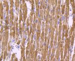 SDHB Antibody in Immunohistochemistry (Paraffin) (IHC (P))