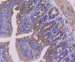 SDHB Antibody in Immunohistochemistry (Paraffin) (IHC (P))