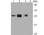 SDHB Antibody in Western Blot (WB)