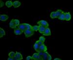 Aminoacylase Antibody in Immunocytochemistry (ICC/IF)