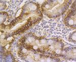 Aminoacylase Antibody in Immunohistochemistry (Paraffin) (IHC (P))