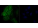 Galectin 3 Antibody in Immunocytochemistry (ICC/IF)