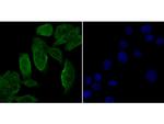 Galectin 3 Antibody in Immunocytochemistry (ICC/IF)