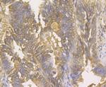 Galectin 3 Antibody in Immunohistochemistry (Paraffin) (IHC (P))