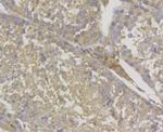 Galectin 3 Antibody in Immunohistochemistry (Paraffin) (IHC (P))