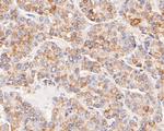 ACADM Antibody in Immunohistochemistry (Paraffin) (IHC (P))