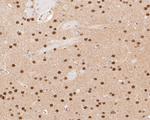 FOXP1 Antibody in Immunohistochemistry (Paraffin) (IHC (P))