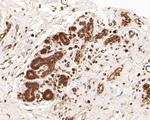 FOXP1 Antibody in Immunohistochemistry (Paraffin) (IHC (P))