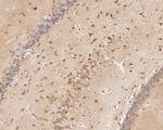 P2X2 Antibody in Immunohistochemistry (Paraffin) (IHC (P))