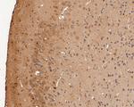 P2X2 Antibody in Immunohistochemistry (Paraffin) (IHC (P))