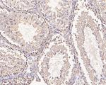 C2orf33 Antibody in Immunohistochemistry (Paraffin) (IHC (P))