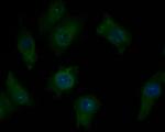 CHRNB2 Antibody in Immunocytochemistry (ICC/IF)