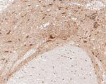 CHRNB2 Antibody in Immunohistochemistry (Paraffin) (IHC (P))