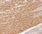 TREM2 Antibody in Immunohistochemistry (Paraffin) (IHC (P))