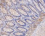 PICK1 Antibody in Immunohistochemistry (Paraffin) (IHC (P))