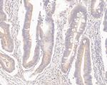 MTHFD2 Antibody in Immunohistochemistry (Paraffin) (IHC (P))