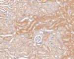 MTHFD2 Antibody in Immunohistochemistry (Paraffin) (IHC (P))