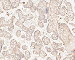 MAGT1 Antibody in Immunohistochemistry (Paraffin) (IHC (P))