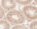 FYCO1 Antibody in Immunohistochemistry (Paraffin) (IHC (P))