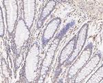 FYCO1 Antibody in Immunohistochemistry (Paraffin) (IHC (P))