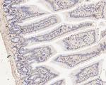 FYCO1 Antibody in Immunohistochemistry (Paraffin) (IHC (P))