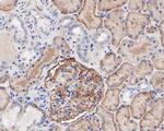 CD35 Antibody in Immunohistochemistry (Paraffin) (IHC (P))