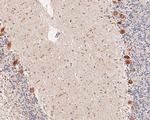 ADAM22 Antibody in Immunohistochemistry (Paraffin) (IHC (P))