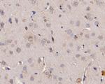 ADAM22 Antibody in Immunohistochemistry (Paraffin) (IHC (P))