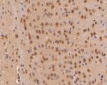 p16INK4a Antibody in Immunohistochemistry (Paraffin) (IHC (P))