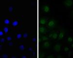 SSB Antibody in Immunocytochemistry (ICC/IF)