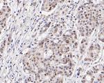 SSB Antibody in Immunohistochemistry (Paraffin) (IHC (P))