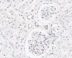 SSB Antibody in Immunohistochemistry (Paraffin) (IHC (P))