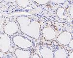 SSB Antibody in Immunohistochemistry (Paraffin) (IHC (P))