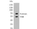 SSB Antibody in Western Blot (WB)