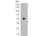 SSB Antibody in Western Blot (WB)