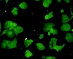 Ubiquitin Antibody in Immunocytochemistry (ICC/IF)