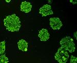 Ubiquitin Antibody in Immunocytochemistry (ICC/IF)