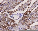 Desmin Antibody in Immunohistochemistry (Paraffin) (IHC (P))