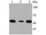 Desmin Antibody in Western Blot (WB)