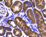 STAT6 Antibody in Immunohistochemistry (Paraffin) (IHC (P))