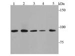 STAT6 Antibody in Western Blot (WB)