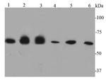 Catalase Antibody in Western Blot (WB)