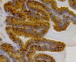 HSP70 Antibody in Immunohistochemistry (Paraffin) (IHC (P))