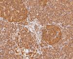 PSMA7 Antibody in Immunohistochemistry (Paraffin) (IHC (P))